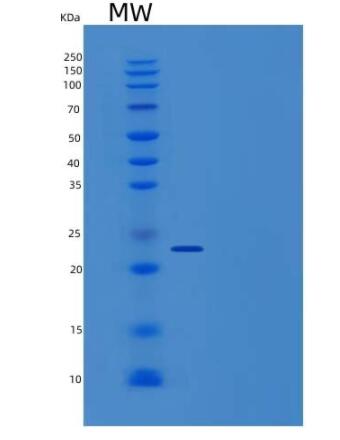 Recombinant Human GH1 / Growth hormone 1 Protein (His tag)