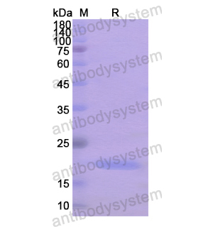 Recombinant Human FOXP2, N-His