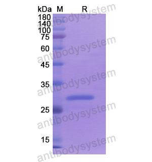 Recombinant Human ABCC3, N-His