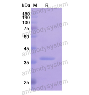 Recombinant Human P4HA2, N-His