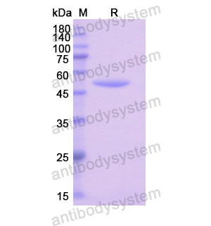 Recombinant Human RS1, N-GST