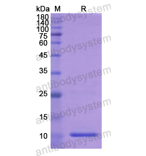 Recombinant Human PLXNB1, N-His