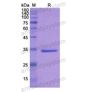 Recombinant Human IRAK2, N-His