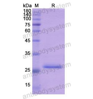 Recombinant Human KLK10, N-His