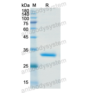 Recombinant Human MAP3K7, N-His