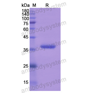 Recombinant Human DHH, N-His