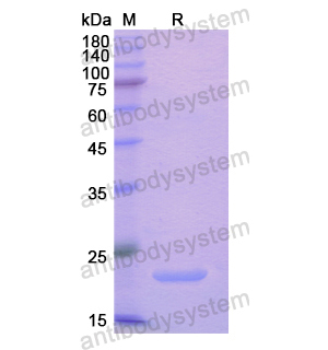 Recombinant Human KLF4, N-His