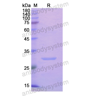 Recombinant Human ADAM20 Protein, N-His