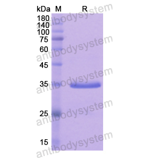 Recombinant Human FOXO3, N-His