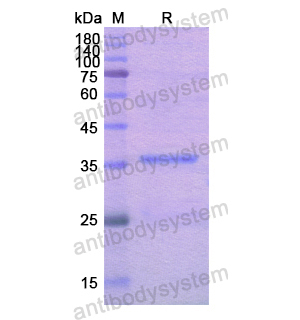 Recombinant Human ACTN4, N-His