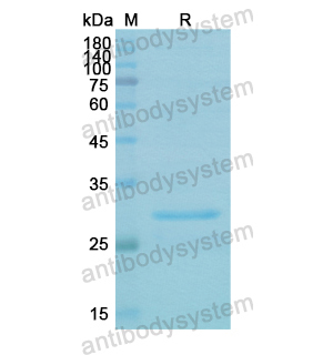 Recombinant Human PRKAB2, N-His