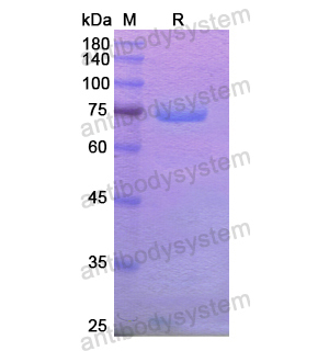 Recombinant Human XPNPEP2, N-His