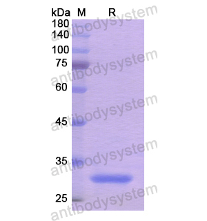 Recombinant Human NRP2, N-His