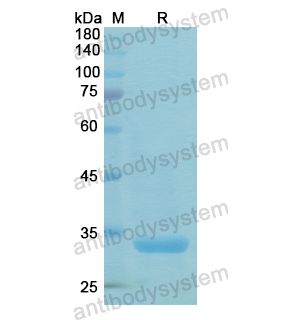 Recombinant Human CTSV, N-His