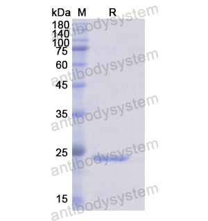 Recombinant Human CD16b/FCGR3B, N-His