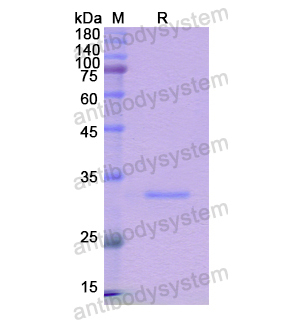 Recombinant Human ABCB7, N-His