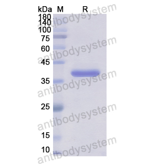 Recombinant Human ATP2C2, N-GST