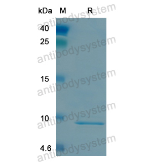 Recombinant Human LRP5, N-His