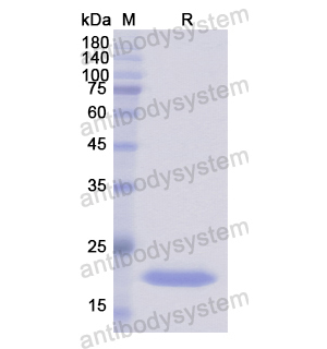 Recombinant Human GADD45B, N-His