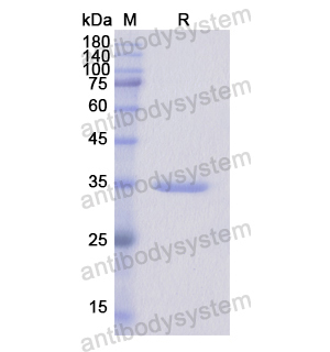 Recombinant Human CS, N-His