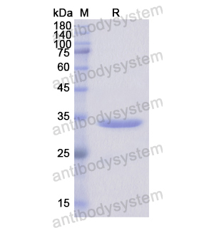 Recombinant Human ITGA10, N-His