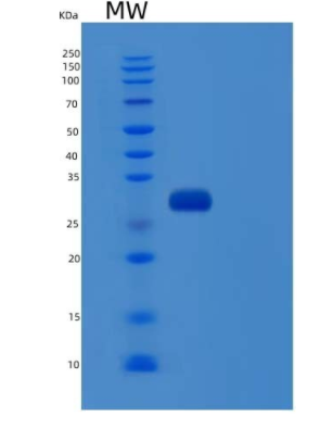 Recombinant Human Ubiquitin Carboxyl-Terminal Hydrolase Isozyme L3/UCH-L3 Protein(C-6His)