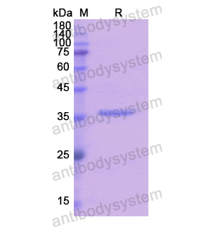 Recombinant Human TRPA1, N-His