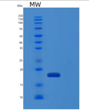 Recombinant Human IL-1RA / IL1RN Protein