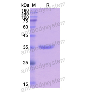 Recombinant Human RNASEH2A, N-His