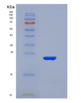 Recombinant Interleukin 2 (IL2).