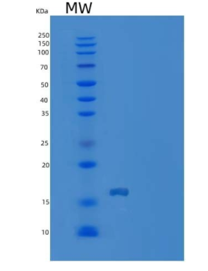 Recombinant Rat IL17F / IL-17F Protein (His tag)