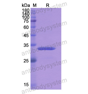 Recombinant Human CBR3, N-His