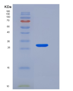 Recombinant Protein A/G (Phycoerythrin)