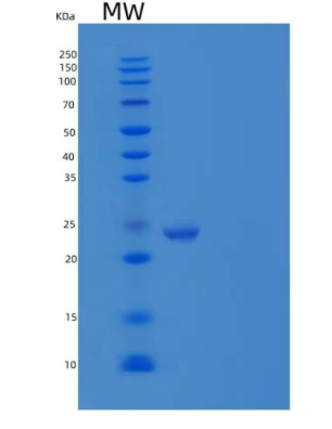 Recombinant Human Synaptobrevin Homolog YKT6/YKT6 Protein(N-6His)