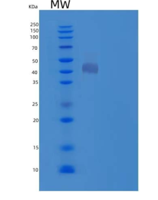 Recombinant Mouse Cathepsin D Protein