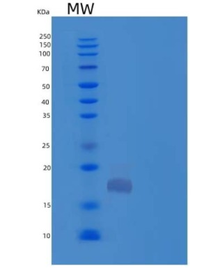 Recombinant Human Thioredoxin Domain-Containing Protein 12/TXNDC12/ERp18 Protein(C-6His)