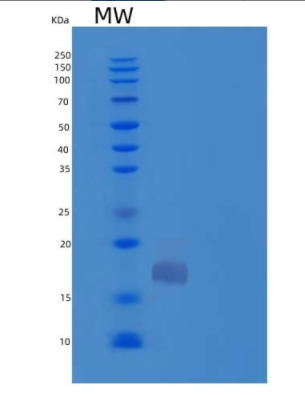 Recombinant Mouse Fibrillin-1/Asprosin Protein(N-8His)