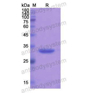 Recombinant Human DGAT1, N-His