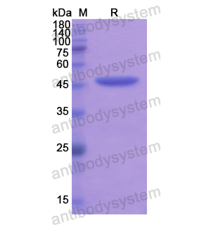 Recombinant Human SOAT2, N-His