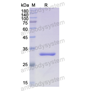 Recombinant Human B3GAT3, N-His