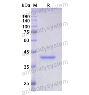 Recombinant Human CCNB2, N-His