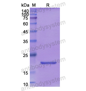 Recombinant Human SCEL, N-His