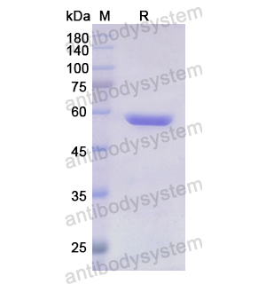 Recombinant Human FARS2, N-His