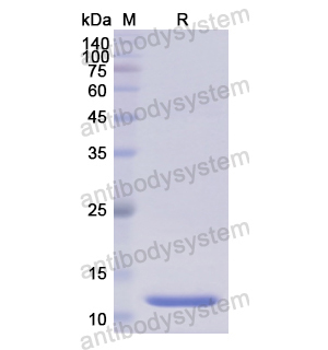 Recombinant Human UTS2, N-His