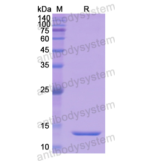 Recombinant Human SLC34A2/NaPi2b, N-His