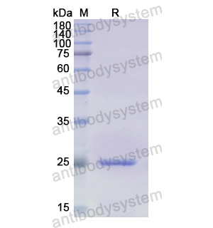 Recombinant Human VNN1, N-His