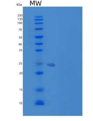 Recombinant Human Hippocalcin-Like Protein 1/HPCAL1 Protein(N-6His)