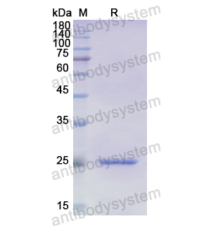 Recombinant Human ADCY5, N-His