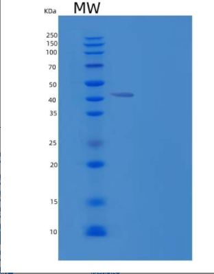 Recombinant Human OBFC1/CST Complex Subunit STN1 Protein(N-6His)