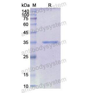 Recombinant Human CXCL14/BRAK/MIP-2G, N-GST